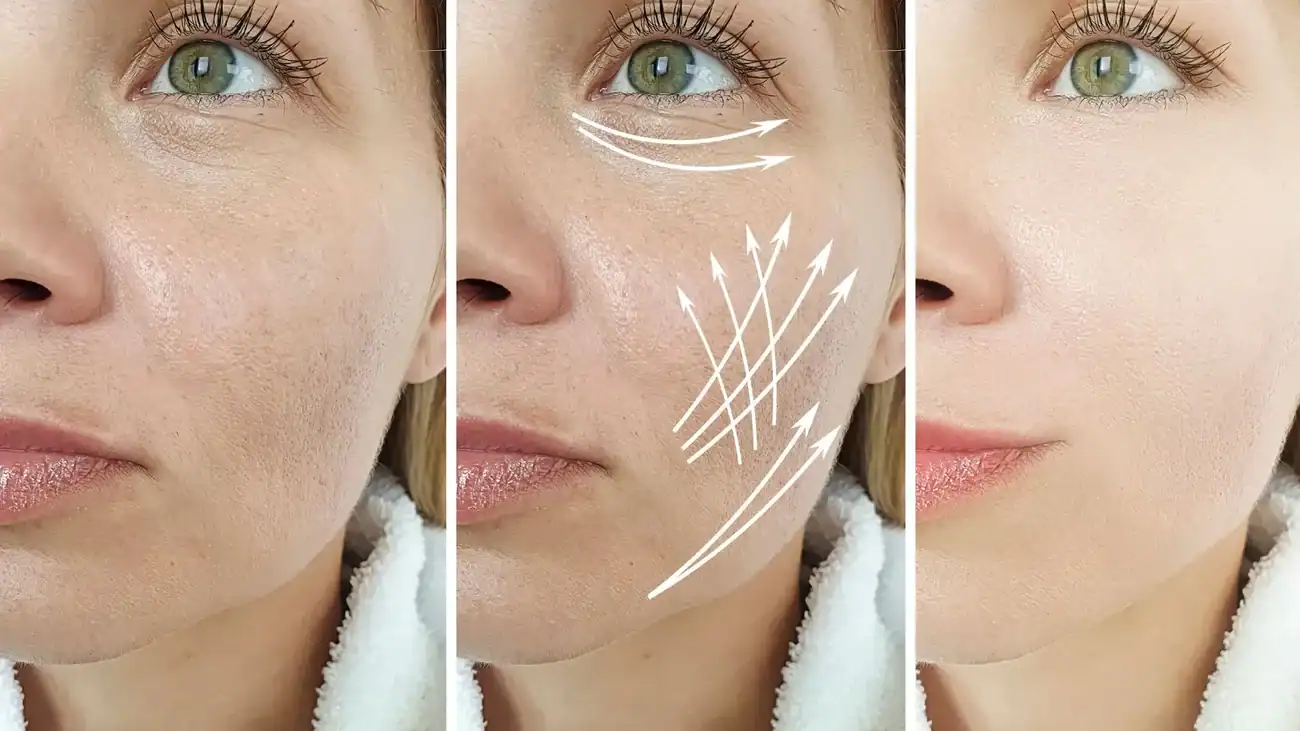 Can One Treatment Really Tackle More Than One Skin Concern Bristol ?