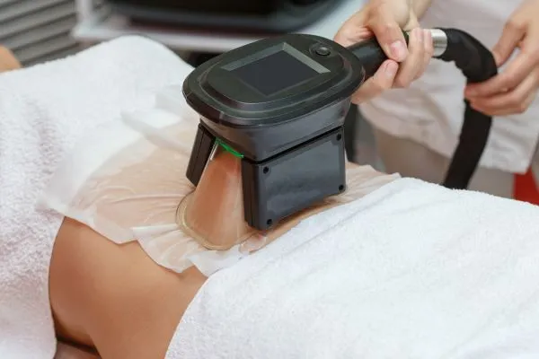 Image of person having fat freezing treatment to help weight gain Bristol
