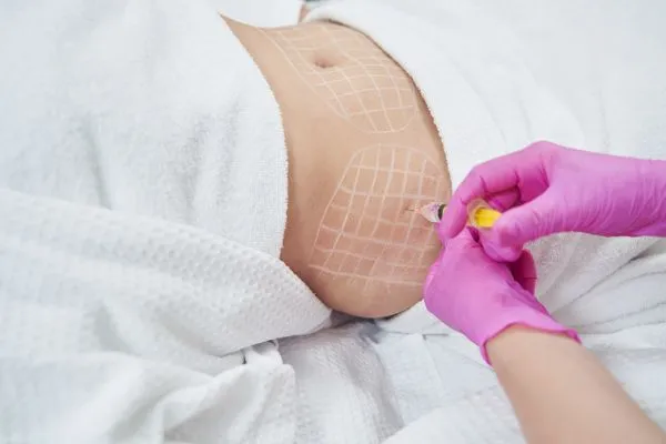 image of fat dissolving injections on love handles to help combat weight gain Bristol