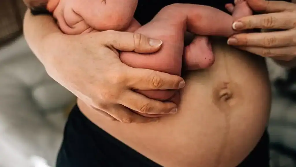 Why Is My Stomach Still Big After Pregnancy Bristol ?
